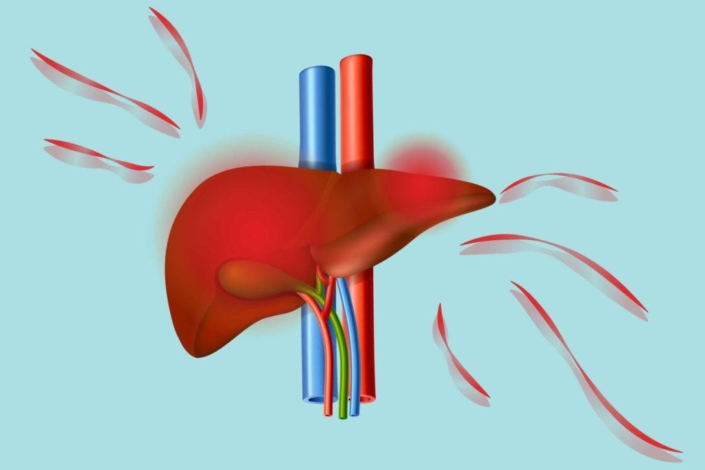 Preventable liver disease is rising: What you eat — and avoid — counts