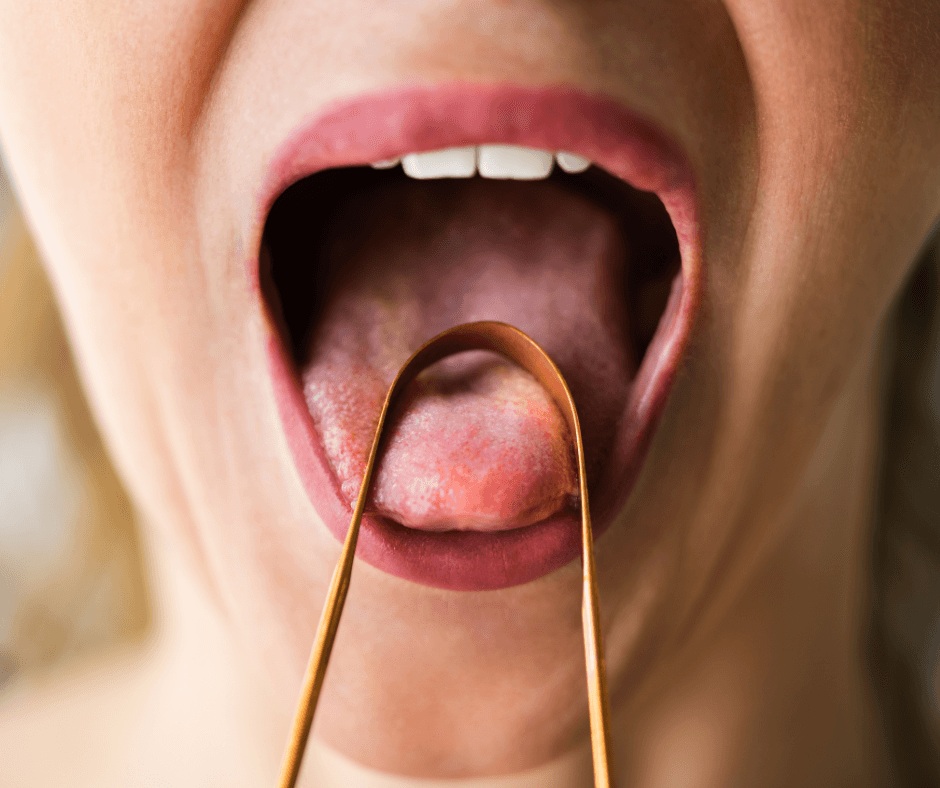 What the state of your tongue really says about your health?